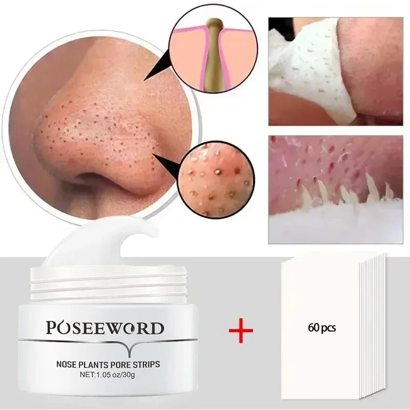 Efficient Blackhead Remover Nose Mask Pore Strip Black Mask Peeling Acne Treatment Black Deep Cleansing Skin Care Korea