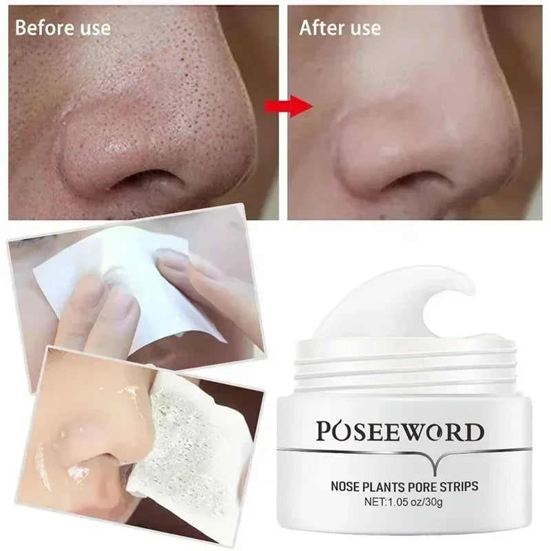 Efficient Blackhead Remover Nose Mask Pore Strip Black Mask Peeling Acne Treatment Black Deep Cleansing Skin Care Korea